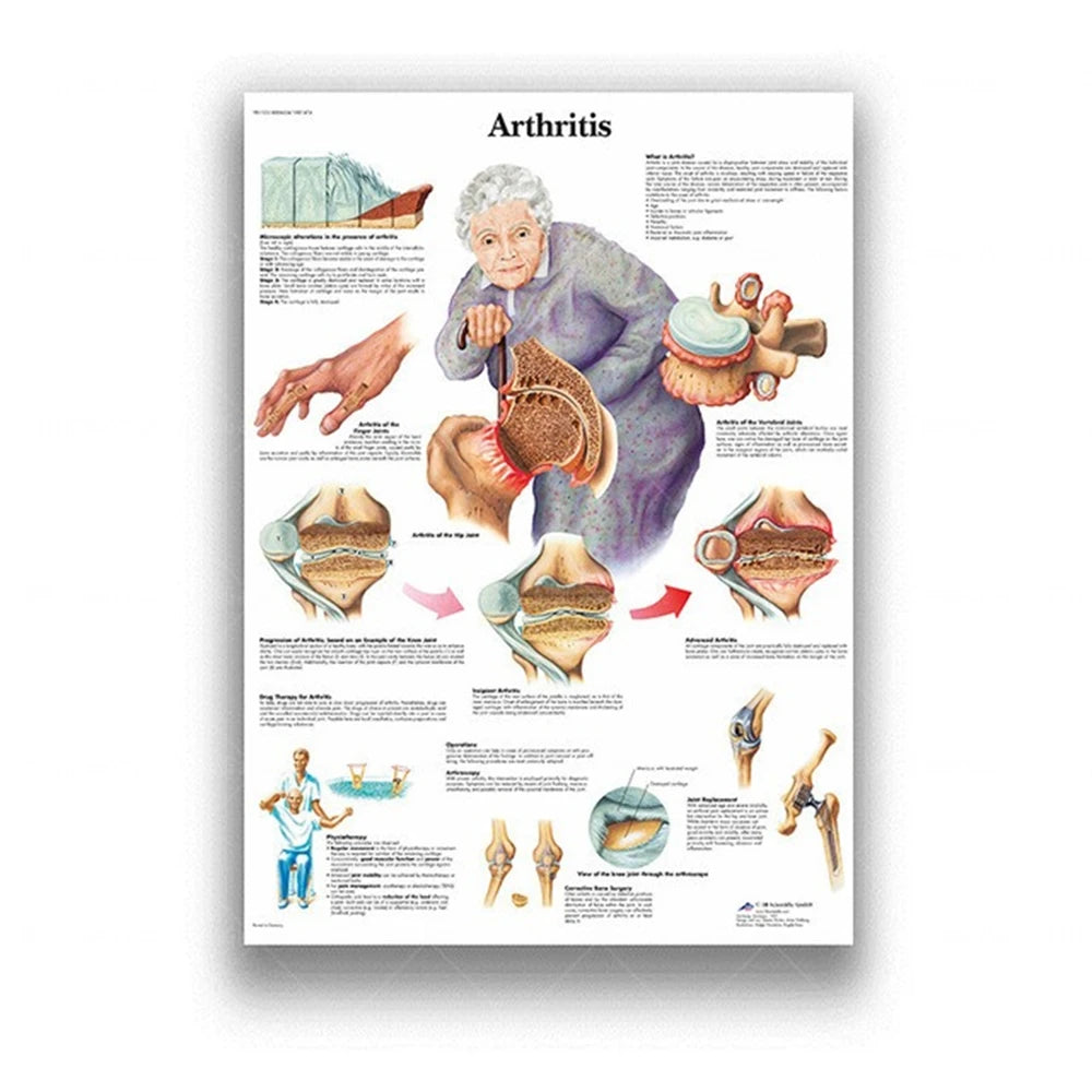 Human Musculoskeletal System Anatomy Poster Human Anatomy Medical Wall Decoration Medical Education Canvas Painting Wall Sticker