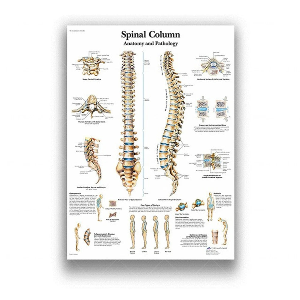 Human Musculoskeletal System Anatomy Poster Human Anatomy Medical Wall Decoration Medical Education Canvas Painting Wall Sticker